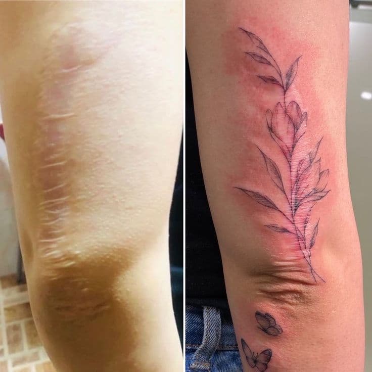 SCAR COVER-UP example 4